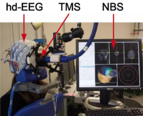 Fig. 1. Set up of the TMS-EEG technique. Hd-EEG: high-density electroencephalography; TMS: transcranial magnetic stimulation; NBS: