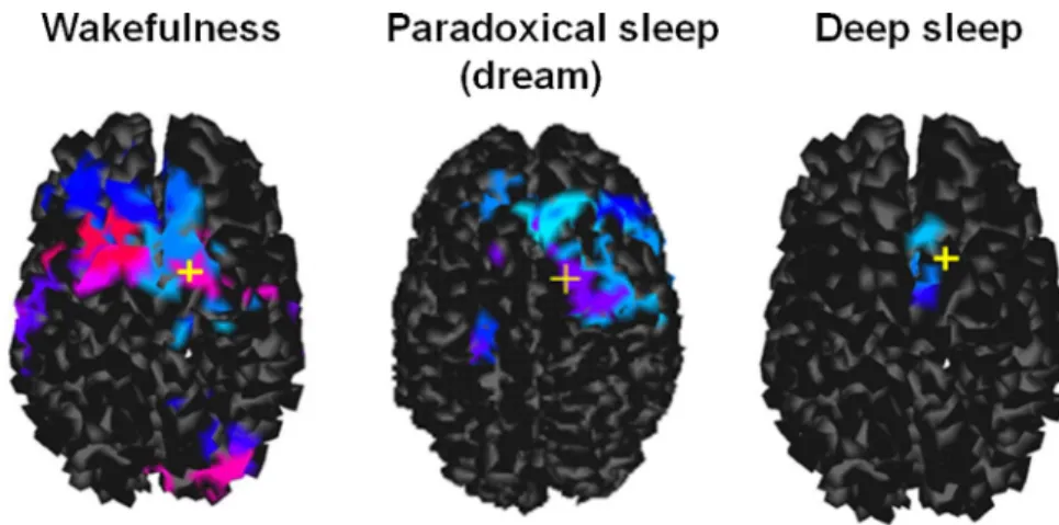 Fig. 4. TMS-EEG responses in sleep as compared to wakefulness. Yellow cross illustrates the site of the TMS stimulation (frontal cortex).