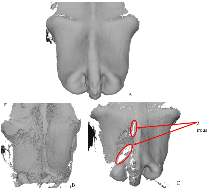 Figure  6 :  Qualité des acquisitions: surface lisse et complète (A), surface discontinue (B),  surface incomplète (C) 