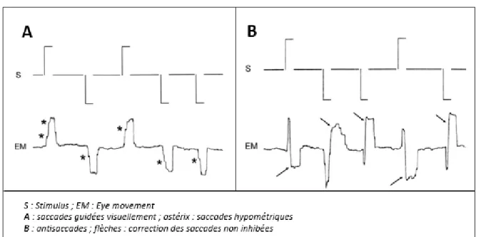 Figure 1 : Enregistrement des mouvements oculaires (d'après Apartis et coll. 2008) 