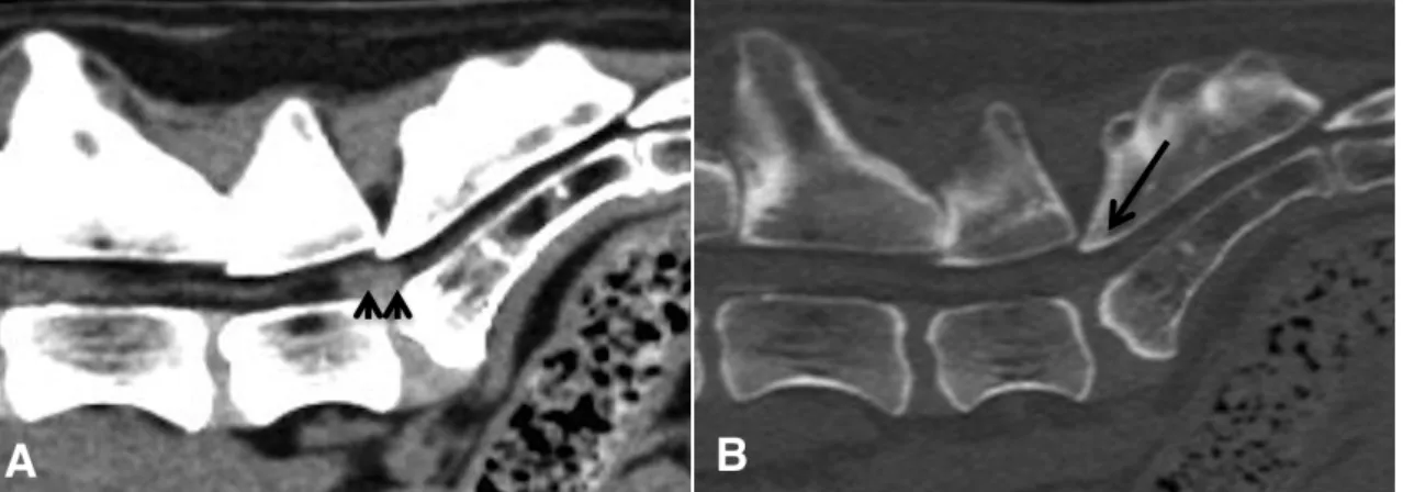 Figure  6:    Computed  Tomography  images  (sagittal  multiplanar  reconstruction)  of  the  lumbosacral  region  of  dog  affected  by  degenerative  lumbosacral  stenosis