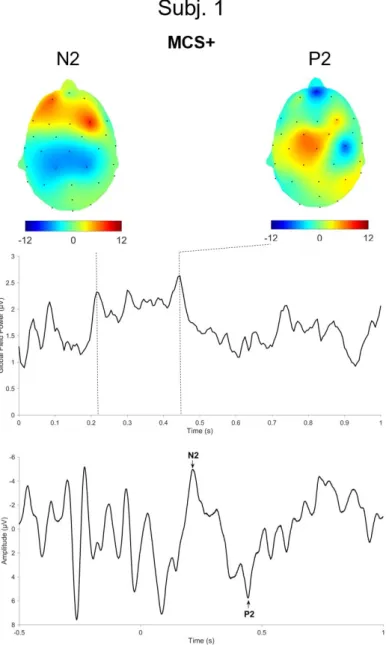 Figure  4.2.   Global  field  power  (GFP)  and  corresponding  topographic  maps  of  nociceptive  event-related brain potentials (LEPs)