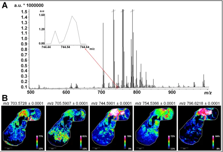 Figure 2. Large scale lipid analysis by MALDI MSI for low-abundant lipids of biological  relevance targeting