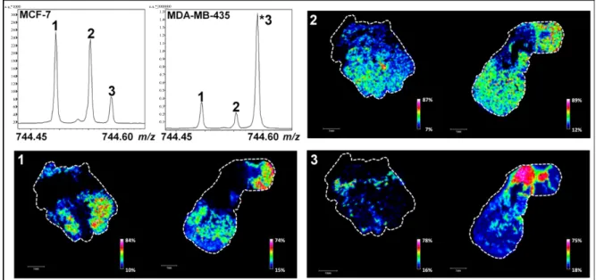 Figure  4. MALDI MSI analyses of MCF-7 (to the left) and MDA-MB-435 (to the right)  tumor  sections  in  narrowband  mode