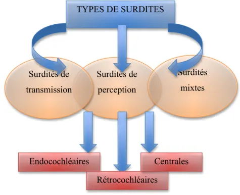 Fig 2 : Présentation des types de surdités (D’après Ayache D., Bonfils P., 2006) 