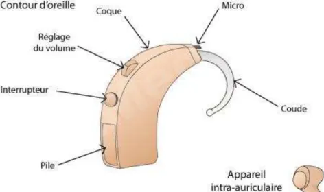 Fig 3 : Schéma du contour d’oreille et de l’appareil intra-auriculaire (d’après le site  www.comprendrechoisir.com) 
