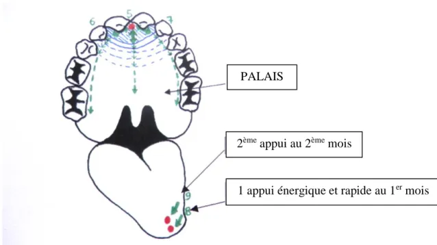 Figure 6 : Schéma des stimulations sur le palais et la languePALAIS 