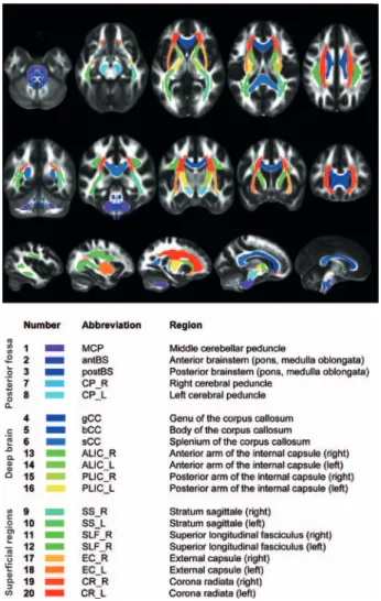 Fig. 1. Automatically segmented white matter tracks for  measurement of diffusion tensor imaging variables.