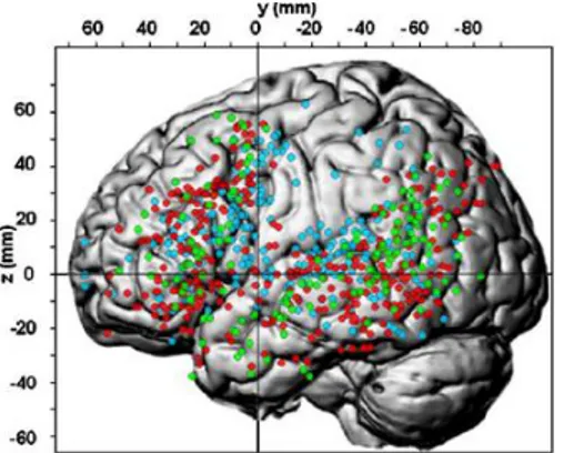 Figure 7 : Méta-analyse des aires du langage de l’HG  