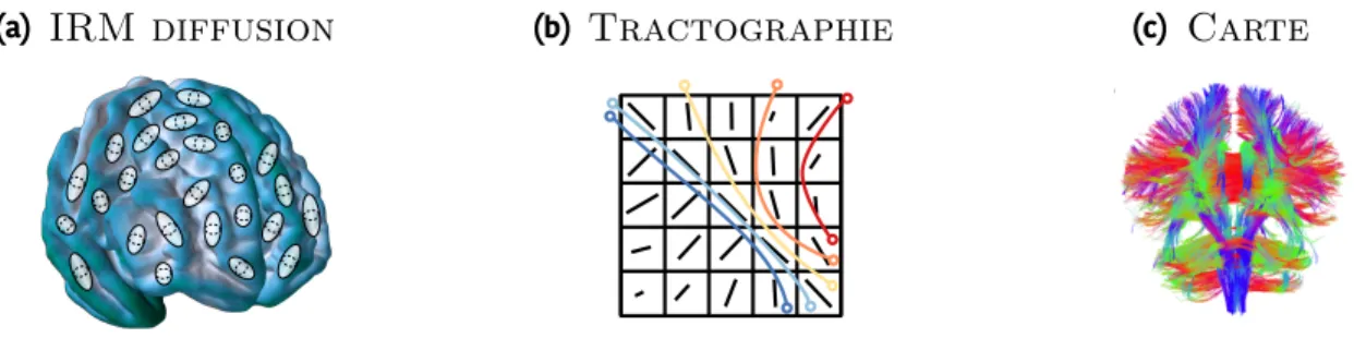 Figure 1.10 – Schématisation du processus de création d’un réseau structurel. À l’aide d’une IRM, on mesure l’anisotropie de la diffusion de l’eau dans le cerveau (a)