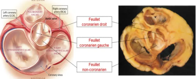 Figure 1-4 Coupes basales schématique et anatomique du cœur montrant la valve aortique et la  position des feuillets aortiques  