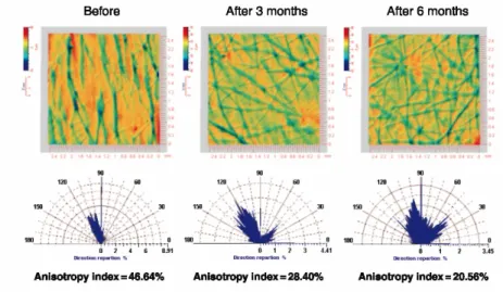 Figure 2. Example showing the reappearance of the isotropic morphology of skin relief and thus the decrease of  the anisotropy index