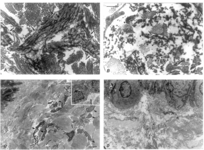 Figure 3. Representative pictures illustrating the ultrastructural changes observed in chronically photodamaged  skin treated with (a,c) topical vitamin C and (b,d) its placebo