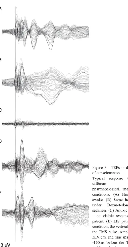 Figure  3  -  TEPs  in  different  states  of consciousness 