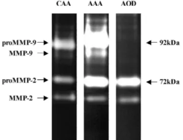 Fig. 4. Representative example of MMP-2 and MMP-9 activity under latent or activated forms measured by  gelatin zymography in extracts of normal (CAA) and diseased aortic wall (AAA and AOD).