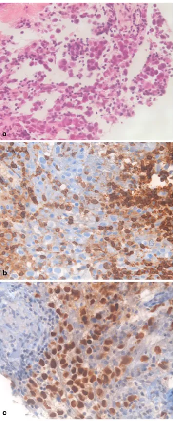 Fig. 3  Photomicrographs of histological findings (original magnifica- magnifica-tion × 400)