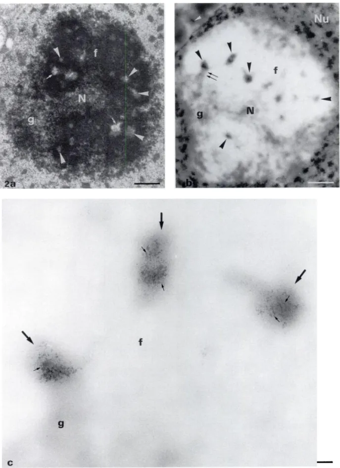 Figure 2. (a) Electron micrograph of a Lowicryl K4M-embedded nucleolus (N) of Zea mays, a monocotyledon