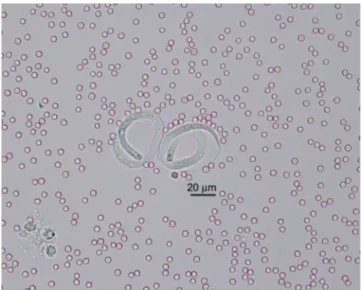 TABLE 2:   Blood analysis of three animals infected with  Parafilaria  bovicola