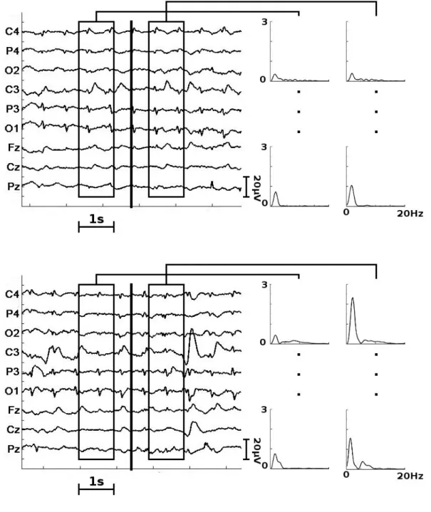 Figure 1. Computation of reactivity. Left, a subset of the original EEG. The black vertical line  indicates the stimulation