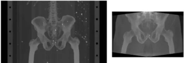 Figure 1: Sample volumes (MIP projections) from our dataset. On the left, a CT scan, on the right, a CBCT scan.