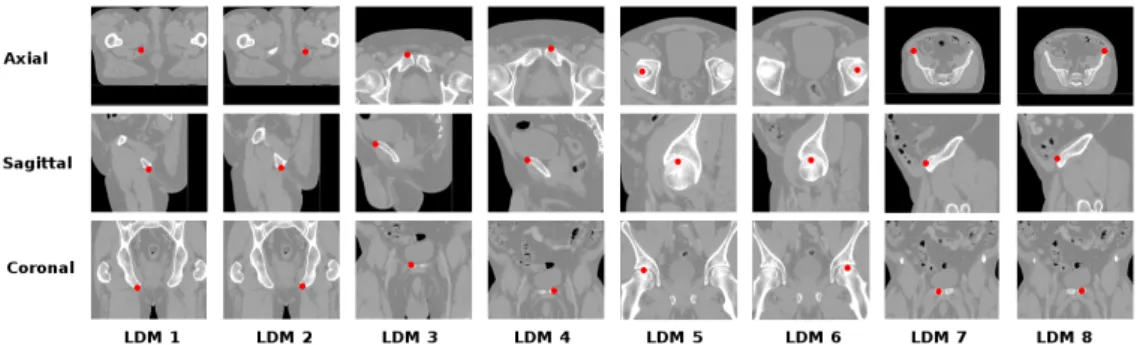 Figure 4: Representative pictures showing the position of the 8 landmarks on a CT-scan.