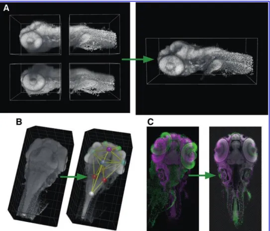 FIG. 5. Image analysis in ViBE-Z: (A) Stitching and multi-view fusion with  atten-uation correction creates a high-quality data set of a 72 hpf zebrafish larva
