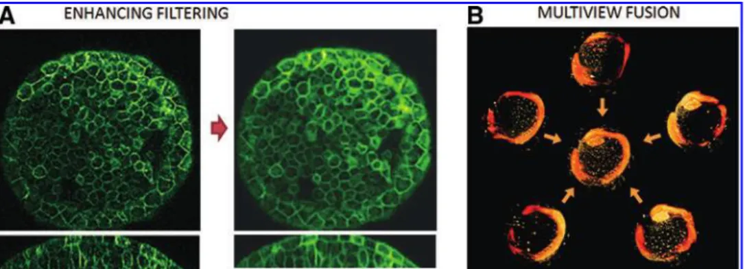 FIG. 3. (A) Cross-sections of a zebrafish embryo image filtered following the approach by Luengo-Oroz 52