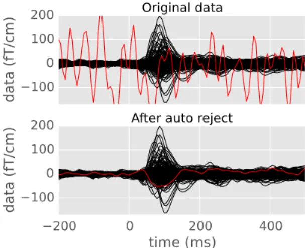 Fig. 4: RMSE with no rejection applied, auto reject (global), and RANSAC. Each point represents a subject from the Faces dataset [15]