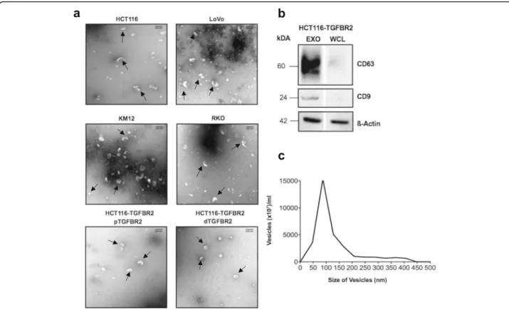Fig. 1 Characterization of isolated exosomes. a Transmission electron microscopy (TEM) illustrates the size and shape of exosomes ( indicated by arrows ) isolated from different MSI colorectal cancer cell lines (HCT116, LoVo, KM12, RKO) and from the model 