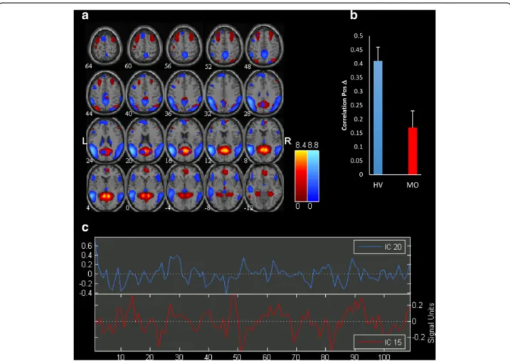 Fig. 2 a Representation of the two significant Independent Components (IC) functional connectivity networks differing in migraine patients scanned between attacks (MO) compared with healthy volunteers (HV) separated by independent component analysis (ICA)