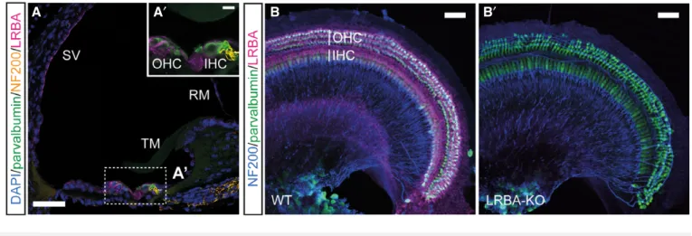 Figure 1 . LRBA expression in the organ of Corti.