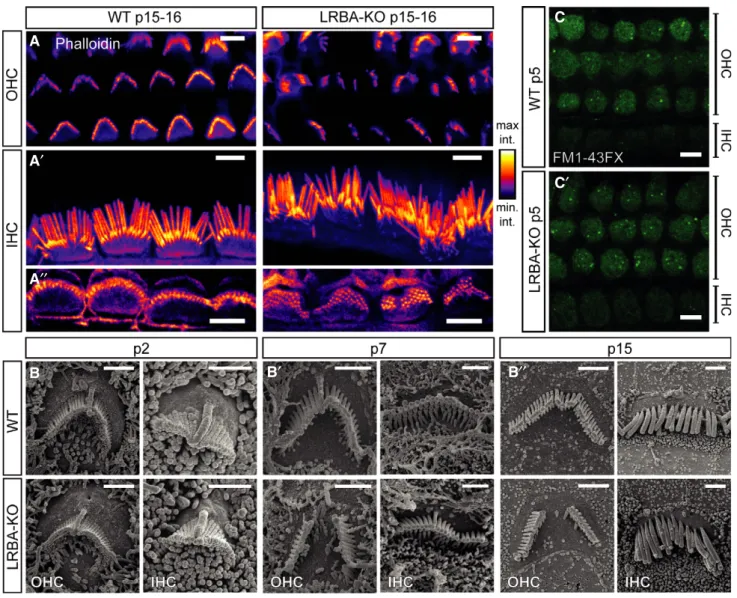 Figure 5. Hair bundles of Lrba-KO hair cells develop a prominent central gap in their stereociliar array.