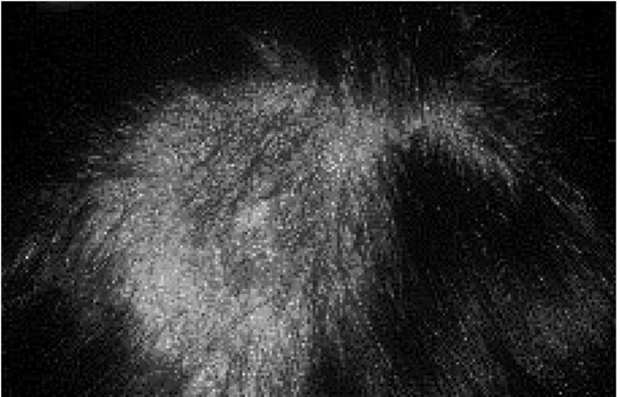Fig. 2. Teigne à Microsporum canis.