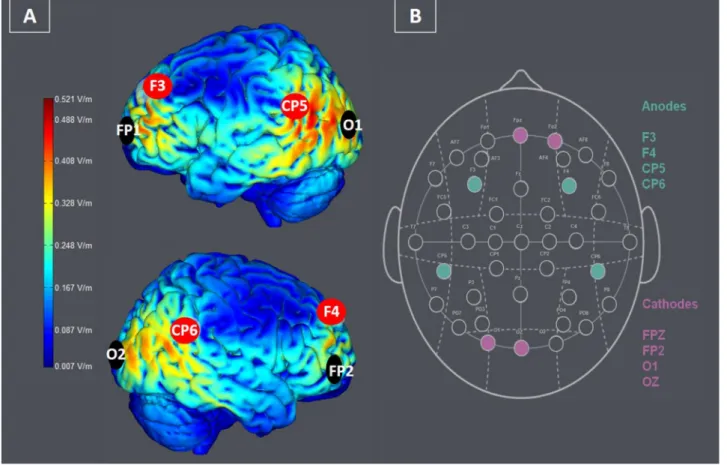 Fig. 1. E-field modelling with anodes in red and cathodes in black (A) and tDCS montage used (B)