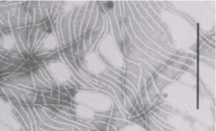 Figure 8. Purified virions of BBrMV; bar represents 400 nm (JE Thomas). 
