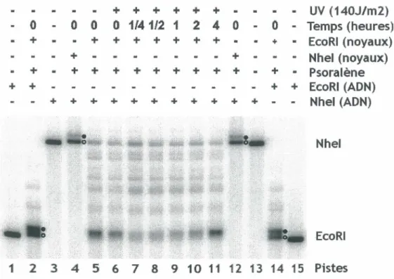 Figure 4: Séparation des gènes ribosomaux actifs et inactifs par digestion de noyaux. 