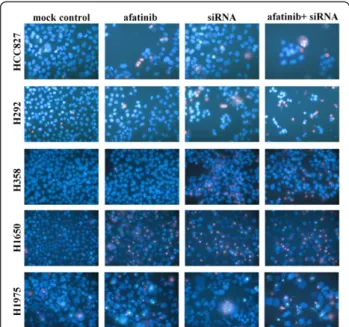 Figure 9 Effect of combination of EGFR siRNA and afatinib with Hoechst 33342 and PI double fluorescent staining