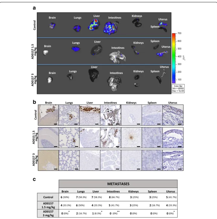 Fig. 3 AD0157 prevents distant metastases. a Representative ex vivo bioluminescent signals of distant organs (brain, lungs, liver, intestines, kidneys, spleen, and uterus)