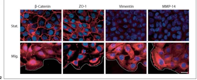 Fig. 2:  Differential expression and localization of β-catenin, ZO-1, vimentin and MMP-14 in migratory versus stationary MCF10A human  breast cells