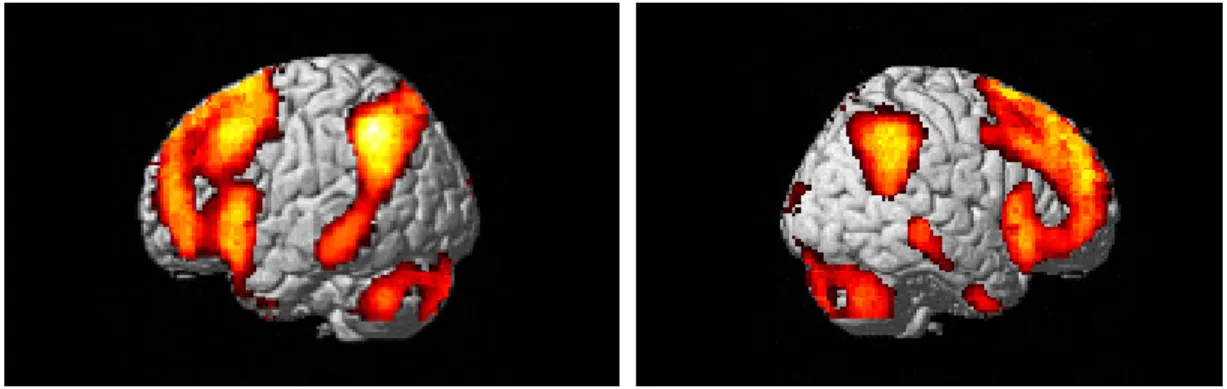 Figure 2: Activated brain regions for the contrast of decrease > watch for the negative pictures  independently of the group before the EC training (first scanning)