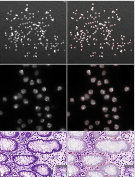 Figure 4. Sample Images from the BIA- BIA-FLOWS Online Instance Illustrating Several BIA Problem Classes, and Results from Associated Workflows