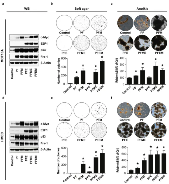 Figure 6: Fra-1, TP53, MYC and E2F1 cooperatively induce oncogenic transformation of non-malignant breast cancer  and mammary epithelial cells