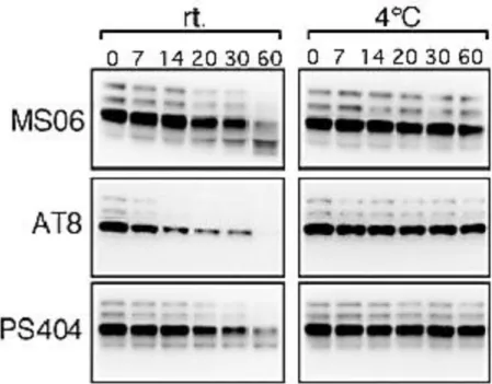 Figure 8. Post-mortem dephosphorylation as a function of time. Phosphorylation levels  were compared by Western blot using MS06, AT8 and pS404 antibodies at 0, 7, 14, 20, 30  and 60 minutes post-mortem for two different temperatures, RT and 4°C