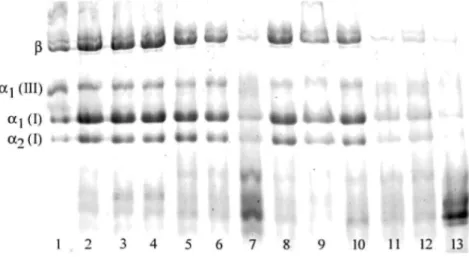 FIG. 1. Example of collagen electrophoresis in SDS-polyacrylamide gel. Lane 1: control collagen from human  skin