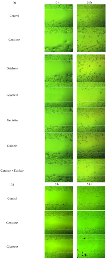 Figure  3.  Cytotoxicity  of  bioactive  anticarcinogens  by  alone  or  two-way  combination  treatment  in  MCF-7 (a) and MDA-MB-231 (b) human cancer cells