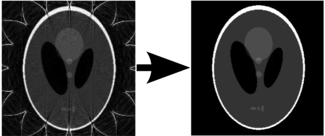 Figure 1.3 Simulation d’amélioration de la qualité d’une image d’une mire Shepp-Logan par correction de canaux défectueux.