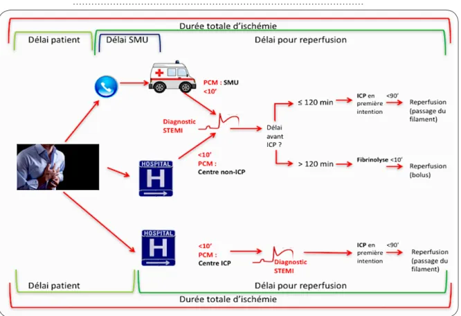 Figure 3. Prise en charge des SCA de type STEMI