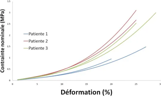 Fig. 1 Courbe contrainte – déformation montrant la reproductibilité intrapatiente et la variabilité interpatiente pour le ligament utérosacré