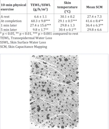 Figure 2: At completion of a 10 min-exercise revealing an irregular pat- pat-tern of dark dots corresponding to openings of sweat gland ducts