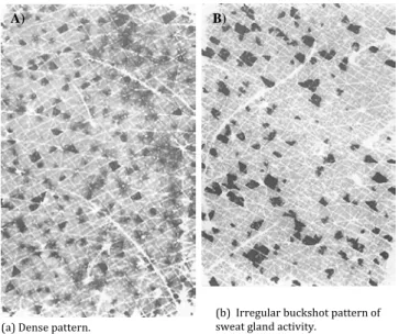 Figure 3: Patterns of sweat gland activity at completion of a 10-min  exercise. The black dots correspond to active sweat pores.